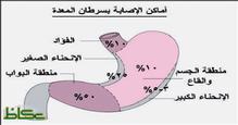 95% من إصابات سرطان المعدة سببها الفقر