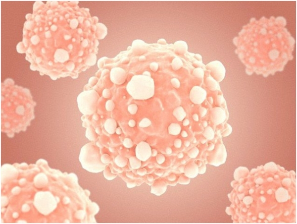 حقن الملح للقضاء على الخلايا السرطانية