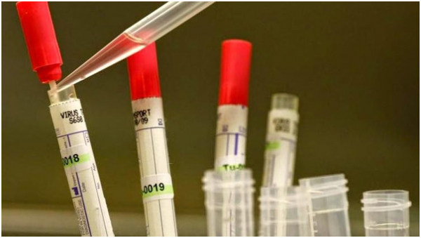 اختبار جديد لتشخيص فيروس "إيبولا" في دقائق