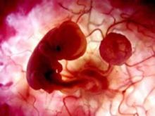 التخصيب الصناعي يزيد من احتمالات الإجهاض 