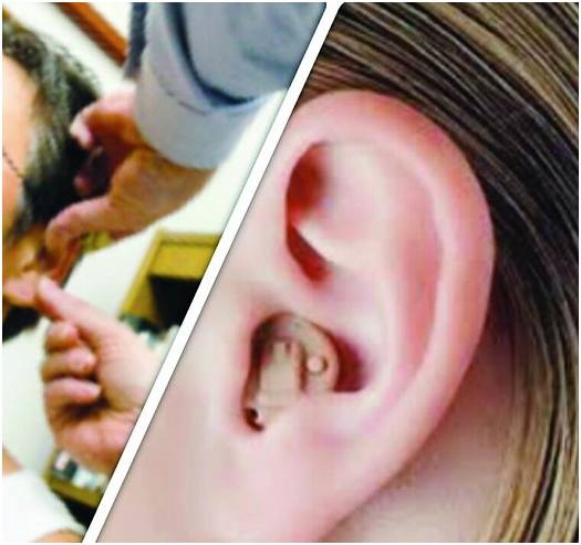 سماعات ضعف السمع تنقذ كبار السن من التدهور الإدراكي