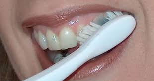 إهمال تنظيف الأسنان يعرضك لمرض الزهايمر