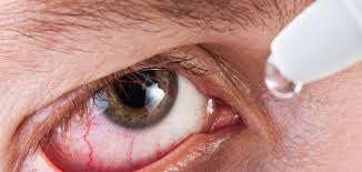 مشاكل شائعة للعين وكيفية التخلص منها؟