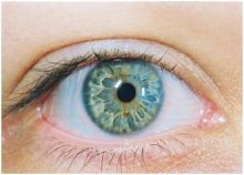 زيت السيليكون يعيق تأثير الإشعاعات على اعضاء العين