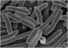 اكتشاف نوع جديد من البكتيريا المقاومة للمضادات الحيوية