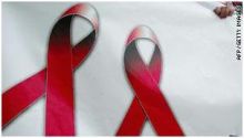 أدلة جديدة عن فيروس نقص المناعة دون أعراض