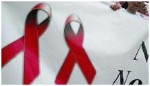 باحثون يتحدثون عن اكتشاف علاج محتمل للإيدز