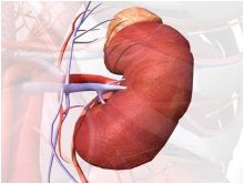  أمراض الكلى تزيد من مخاطر الإصابة بالشريان التاجي