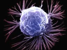 بروتينات لوقف انتشار السرطان