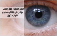 شكل وصحة العين مؤشر على حدوث خلل في الجسد