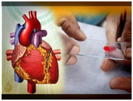 فصيلة الدم تؤثر في الإصابة بأمراض القلب
