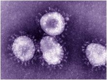"الصحة العالمية": فيروس القطري لا علاقة له بسارس