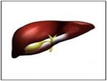 دهون الكبد قد تتسبب بمقاومة الأنسولين