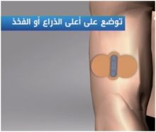 لاصقة كهربائية لعلاج الصداع ومضاعفاته