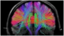 الكتشف عن شبكة معقدة من الوصلات بالدماغ البشري