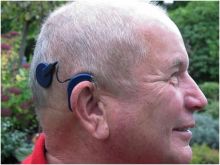 علماء يطورون جهازا يساعد الصم على السمع