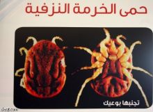 7 حالات مصابة بمرض حمى الخرمة النزفية في مكة ونجران