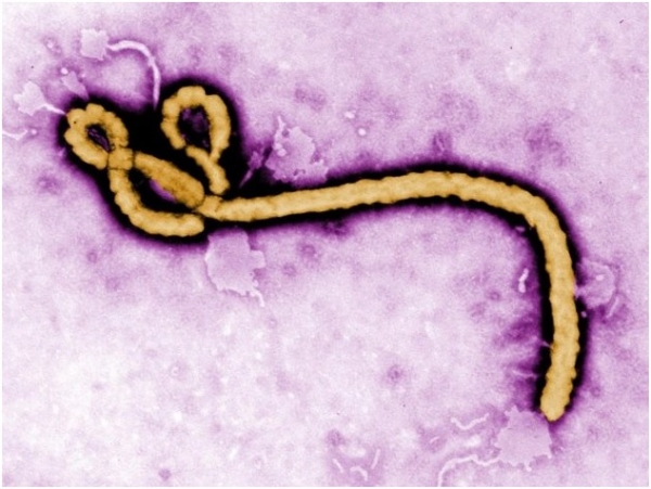 حمى إيبولا النزفية.. الموت القادم من الخفافيش والقردة