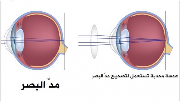 كيف تعمل النظارة؟