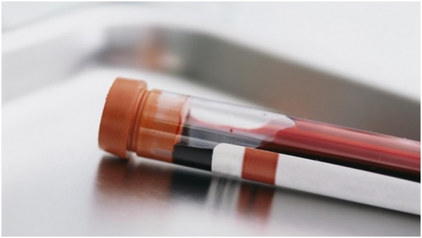 تحليل دم بسيط قد يكشف السرطان والعلاج المناسب